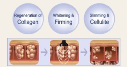 Derma Wave Biopolar RF System HR-S280 (BAG Type)